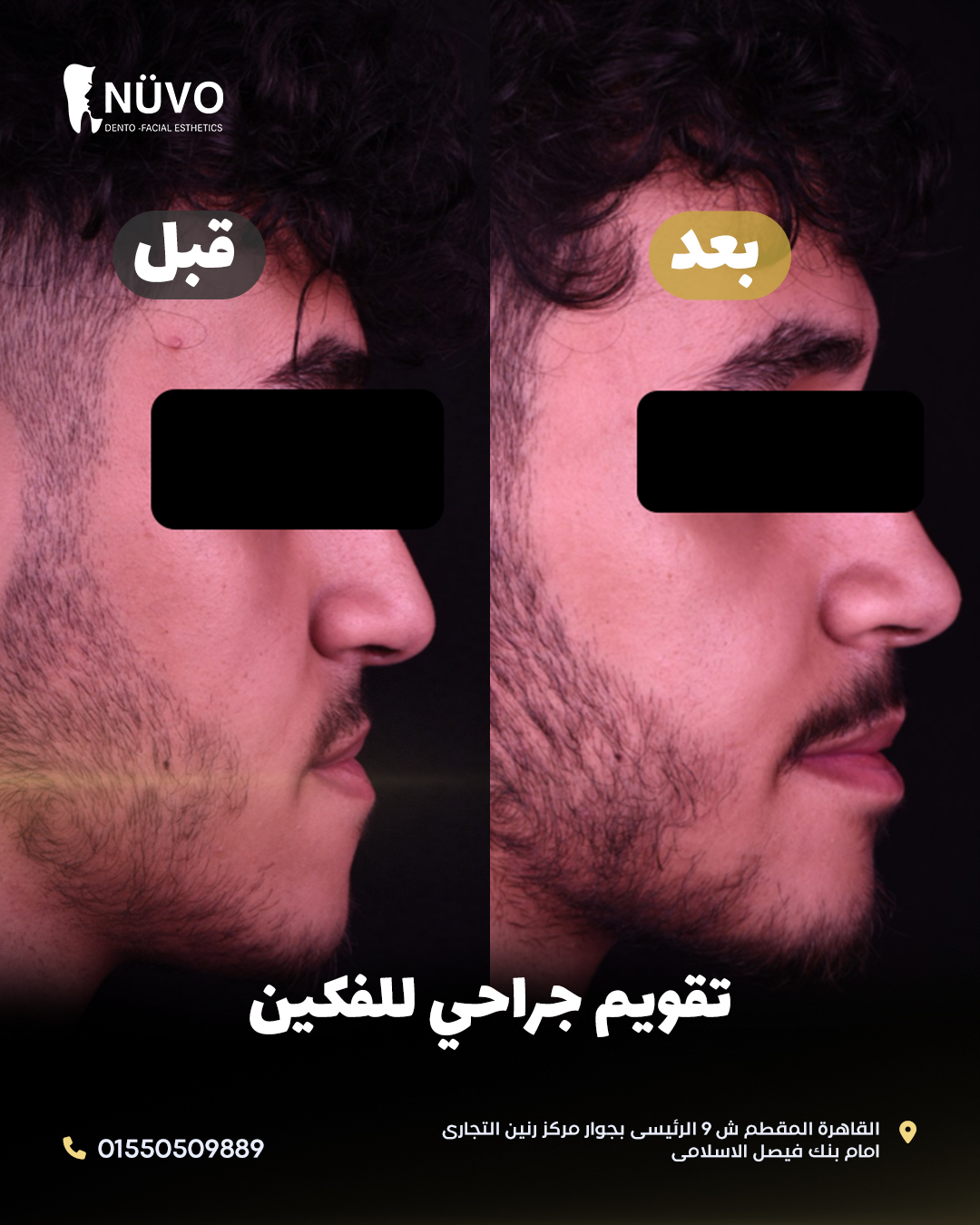 Surgical Orthodontics